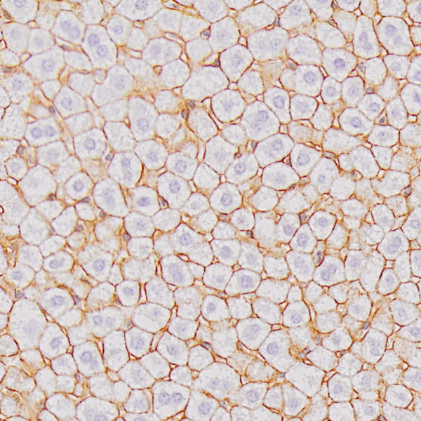 170505 MouseHepatocytes Thumb
