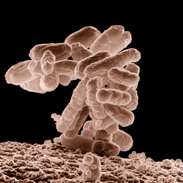 such as this colony of E. coli