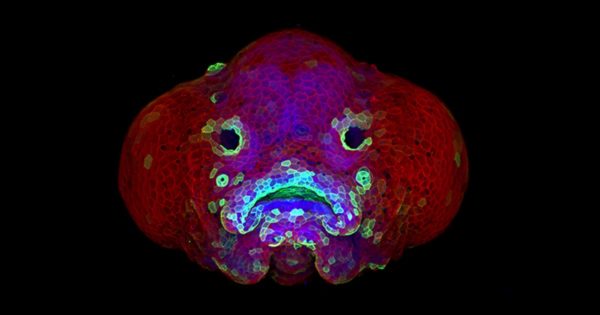 The developing face of a 6-day-old zebrafish larva.