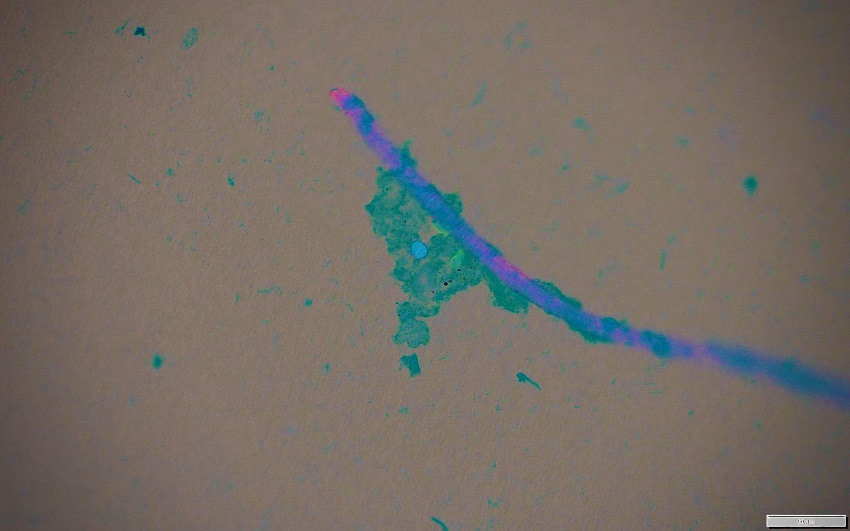 Parasites associated with a microplastics fibre