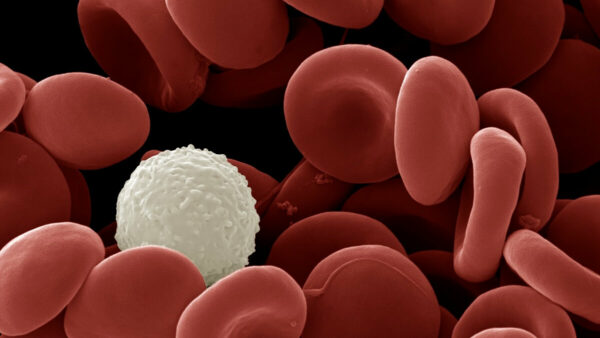 Scanning electron micrograph SEM of human white and red blood cells. Credit David Spears FRPS FRMS Getty Images