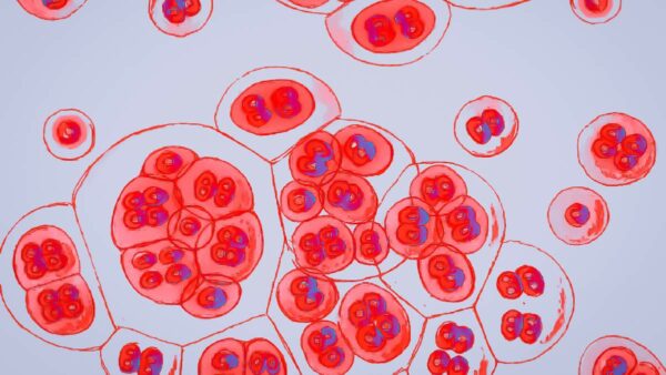 artist's drawing of HIV-infected cells