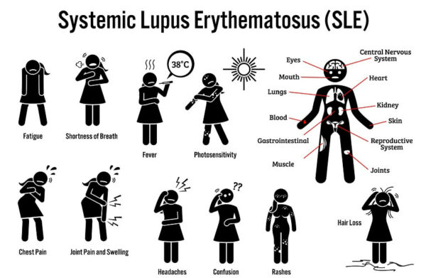 Pictogram showing signs and symptoms of lupus SLE disease