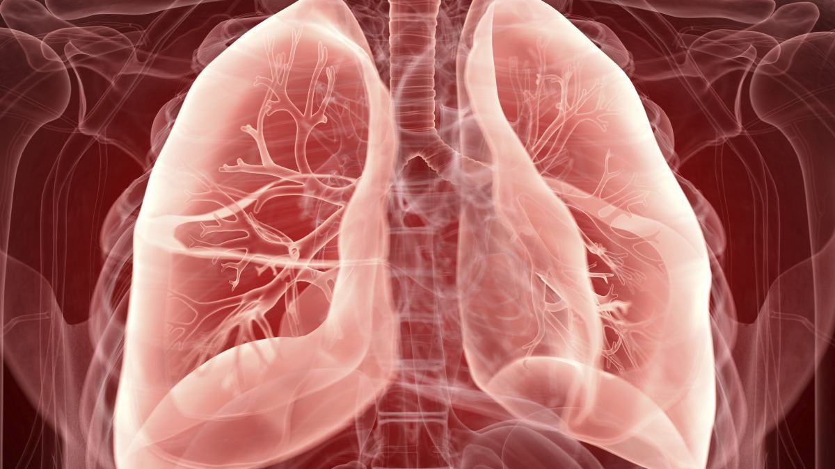 3D image of lungs, evoking lung disease or bronchiectasis