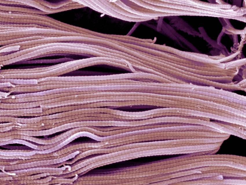 Scanning electron micrograph SEM of collagen bundles. Credit Science Photo Library STEVE GSCHMEISSNER Getty Images