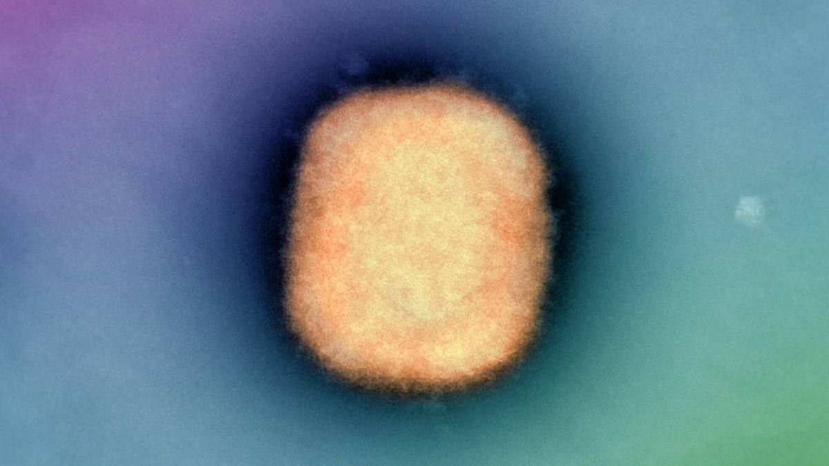 False coloured electron micrograph of a single negative-stained Monkeypox virus particle. Negative contrast transmission electon microscopy using 2% phosphotungstic acin, 52,000x magnification