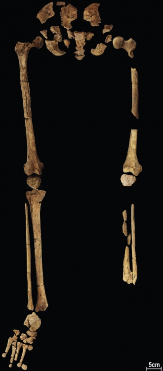 legs-of-borneo-hunter-gatherer-leg-amputated-on-black-backdrop