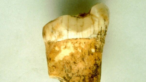 Neanderthal tooth