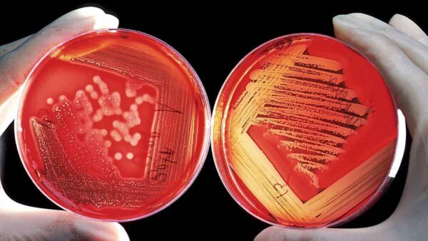 Streptococcus growing on agar plates. antibiotic resistance