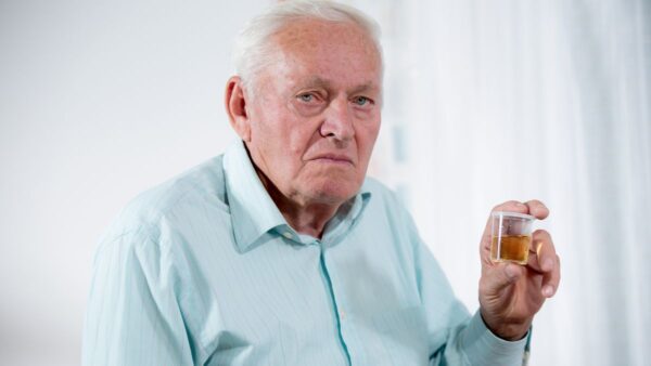 Senior male patient holding urine sample
